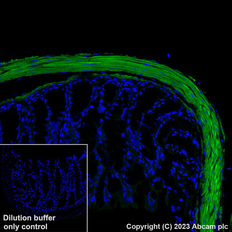 Immunohistochemistry (Formalin/PFA-fixed paraffin-embedded sections) - Alexa Fluor® 488 Anti-Fibronectin antibody [EPR23110-46] (AB314679)