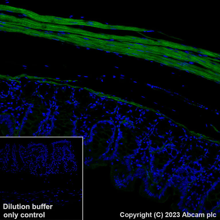 Immunohistochemistry (Formalin/PFA-fixed paraffin-embedded sections) - Alexa Fluor® 488 Anti-Fibronectin antibody [EPR23110-46] (AB314679)