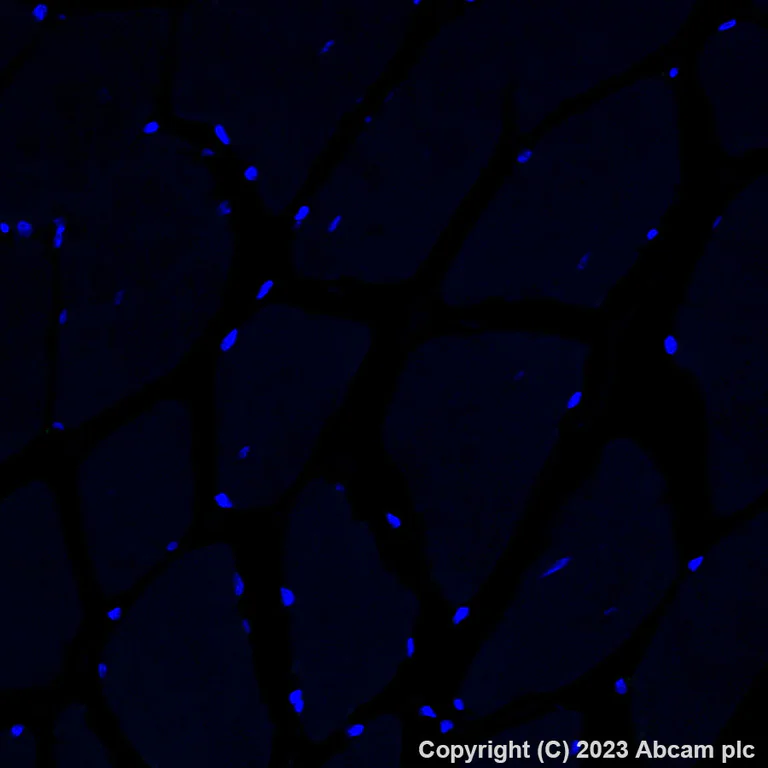 Immunohistochemistry (Formalin/PFA-fixed paraffin-embedded sections) - Alexa Fluor® 488 Anti-Fibronectin antibody [EPR23110-46] (AB314679)