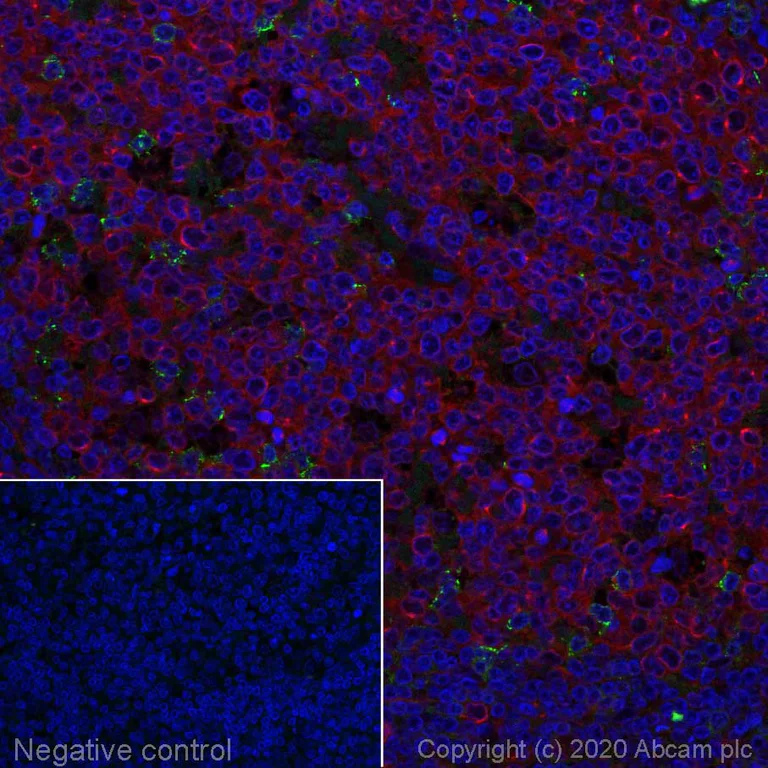 Immunohistochemistry (Formalin/PFA-fixed paraffin-embedded sections) - Alexa Fluor® 488 Anti-Fibronectin antibody [F1] (AB198933)