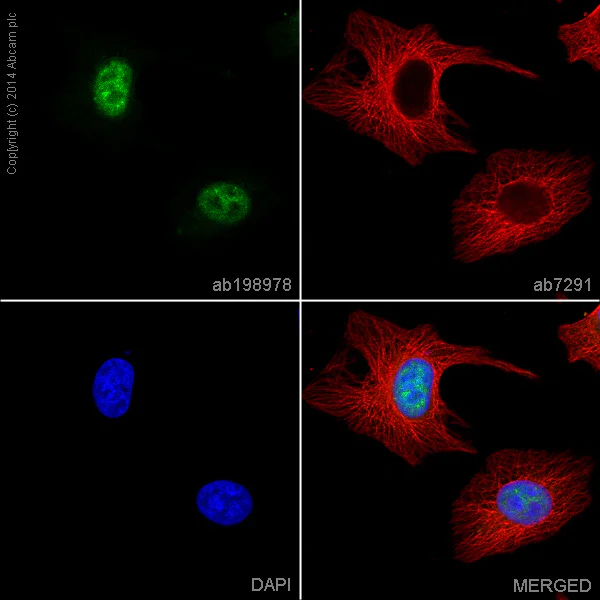 Immunocytochemistry/ Immunofluorescence - Alexa Fluor® 488 Anti-FKBP51 antibody [EPR6617] (AB198978)