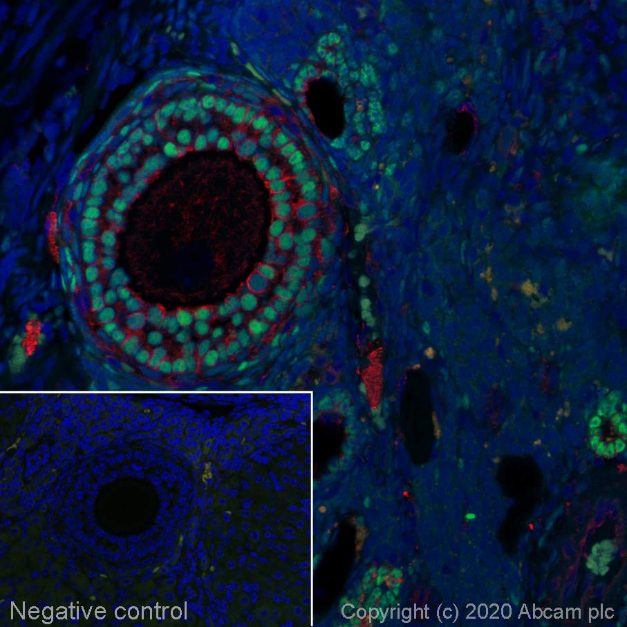 Immunohistochemistry (Formalin/PFA-fixed paraffin-embedded sections) - Alexa Fluor® 488 Anti-FOXL2 antibody [EPR23523-68] (AB275152)
