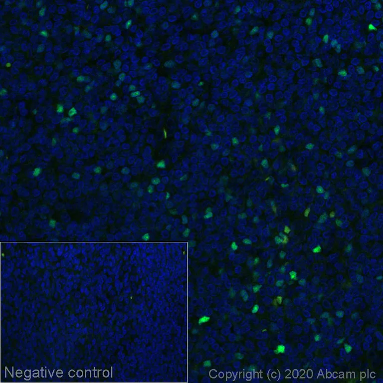 Immunohistochemistry (Formalin/PFA-fixed paraffin-embedded sections) - Alexa Fluor® 488 Anti-FOXP3 antibody [SP97] (AB275119)