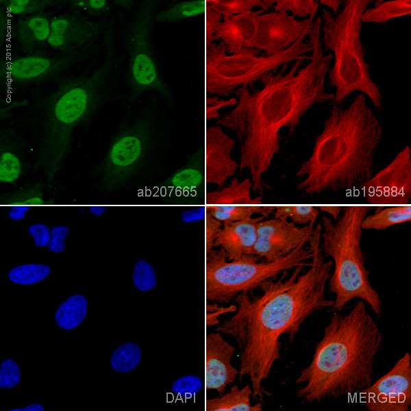 Immunocytochemistry/ Immunofluorescence - Alexa Fluor® 488 Anti-FTO antibody [EPR6894] (AB207665), expandable thumbnail