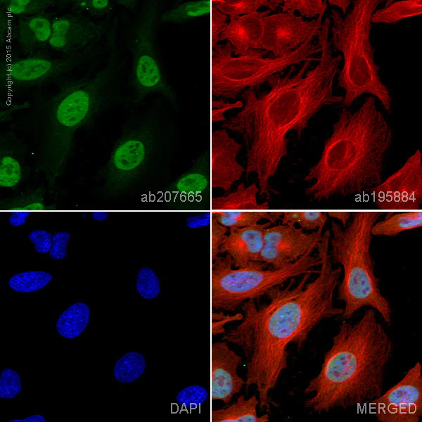 Immunocytochemistry/ Immunofluorescence - Alexa Fluor® 488 Anti-FTO antibody [EPR6894] (AB207665)