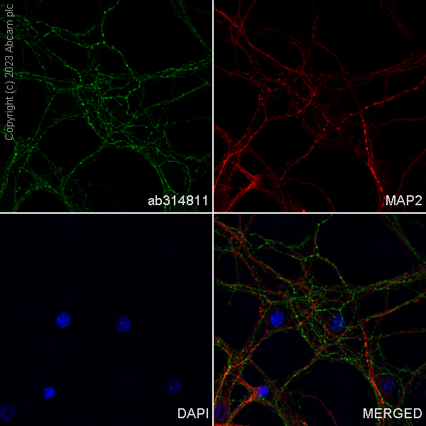 Immunocytochemistry/ Immunofluorescence - Alexa Fluor® 488 Anti-GAD65 + GAD67 antibody [EPR19366] (AB314811), expandable thumbnail