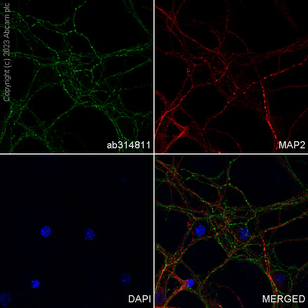 Immunocytochemistry/ Immunofluorescence - Alexa Fluor® 488 Anti-GAD65 + GAD67 antibody [EPR19366] (AB314811)