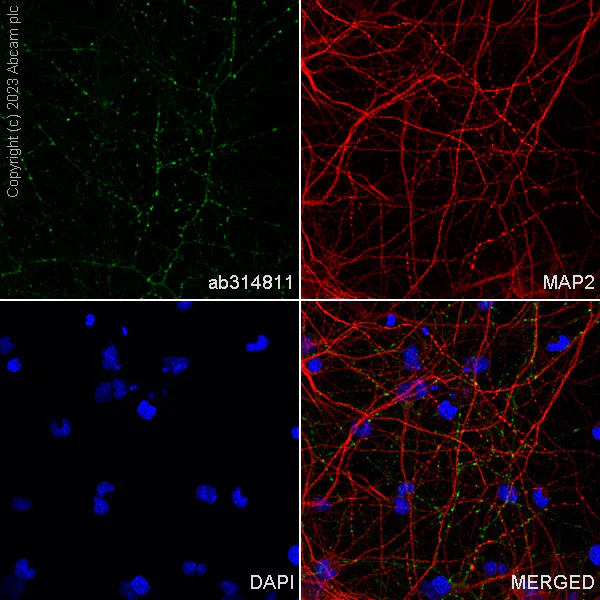 Immunocytochemistry/ Immunofluorescence - Alexa Fluor® 488 Anti-GAD65 + GAD67 antibody [EPR19366] (AB314811)