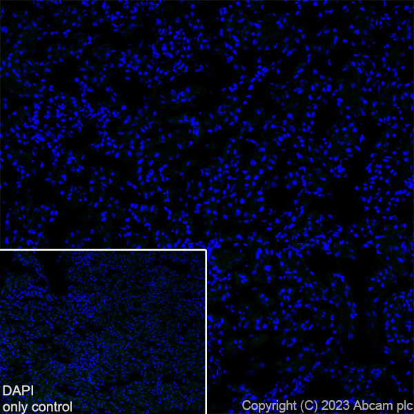 Immunohistochemistry (Formalin/PFA-fixed paraffin-embedded sections) - Alexa Fluor® 488 Anti-GAD65 + GAD67 antibody [EPR19366] (AB314811), expandable thumbnail