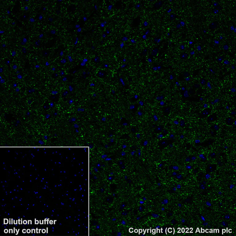 Immunohistochemistry (Formalin/PFA-fixed paraffin-embedded sections) - Alexa Fluor® 488 Anti-GAD67/GAD1 antibody [EPR20578] (AB307854)