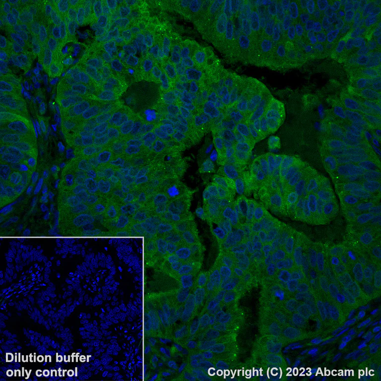 Immunohistochemistry (Formalin/PFA-fixed paraffin-embedded sections) - Alexa Fluor® 488 Anti-Galectin 3 antibody [EP2775Y] (AB309974)