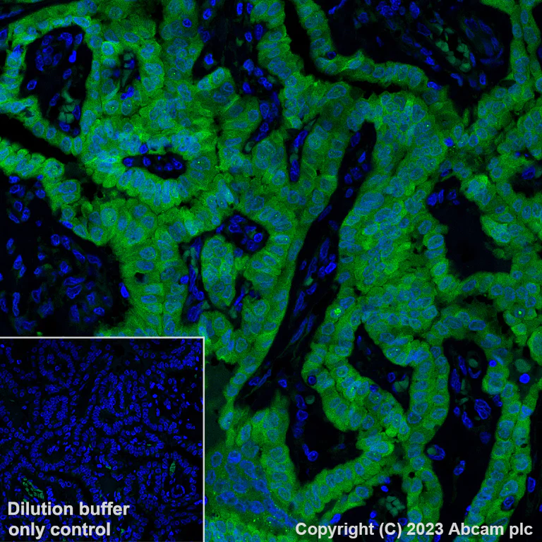 Immunohistochemistry (Formalin/PFA-fixed paraffin-embedded sections) - Alexa Fluor® 488 Anti-Galectin 3 antibody [EP2775Y] (AB309974)