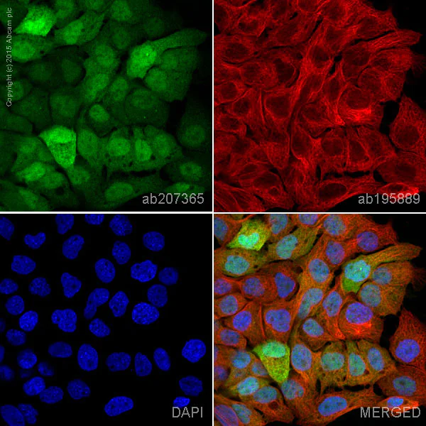 Immunocytochemistry/ Immunofluorescence - Alexa Fluor® 488 Anti-Galectin 7 antibody [EPR4287] (AB207365)