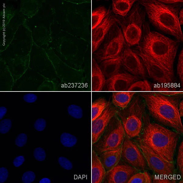 Immunocytochemistry/ Immunofluorescence - Alexa Fluor® 488 Anti-gamma Catenin antibody [EPR17310] (AB237236)