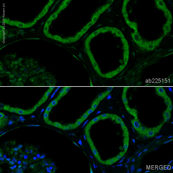 Immunohistochemistry (Formalin/PFA-fixed paraffin-embedded sections) - Alexa Fluor® 488 Anti-GBA antibody [EPR5143(3)] (AB225151)