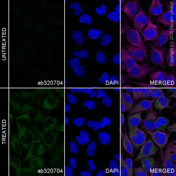 Immunocytochemistry/ Immunofluorescence - Alexa Fluor® 488 Anti-GBP1 antibody [EPR8285] (AB320704)