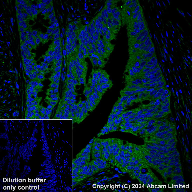 Immunohistochemistry (Formalin/PFA-fixed paraffin-embedded sections) - Alexa Fluor® 488 Anti-GBP1 antibody [EPR8285] (AB320704)