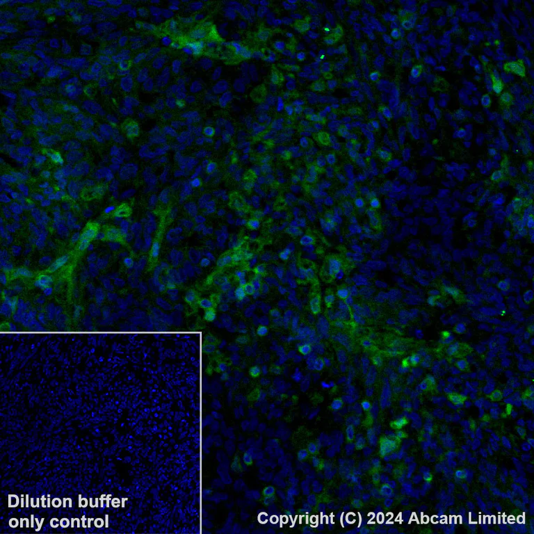 Immunohistochemistry (Formalin/PFA-fixed paraffin-embedded sections) - Alexa Fluor® 488 Anti-GBP1 antibody [EPR8285] (AB320704)