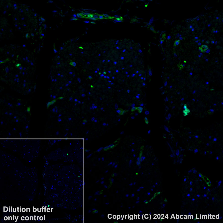 Immunohistochemistry (Formalin/PFA-fixed paraffin-embedded sections) - Alexa Fluor® 488 Anti-GBP1 antibody [EPR8285] (AB320704), expandable thumbnail