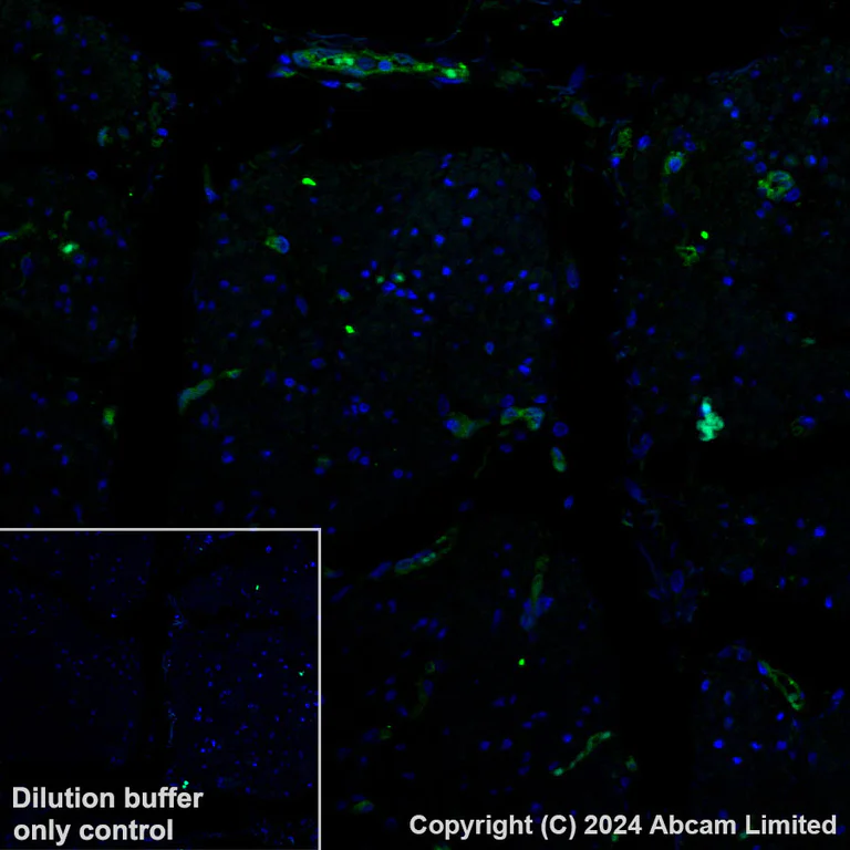 Immunohistochemistry (Formalin/PFA-fixed paraffin-embedded sections) - Alexa Fluor® 488 Anti-GBP1 antibody [EPR8285] (AB320704)
