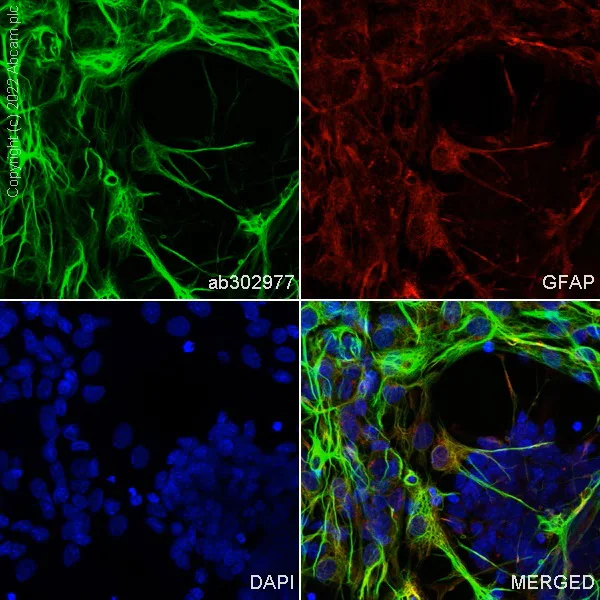 Immunocytochemistry/ Immunofluorescence - Alexa Fluor® 488 Anti-GFAP antibody [EP672Y] - Astrocyte marker (AB302977)