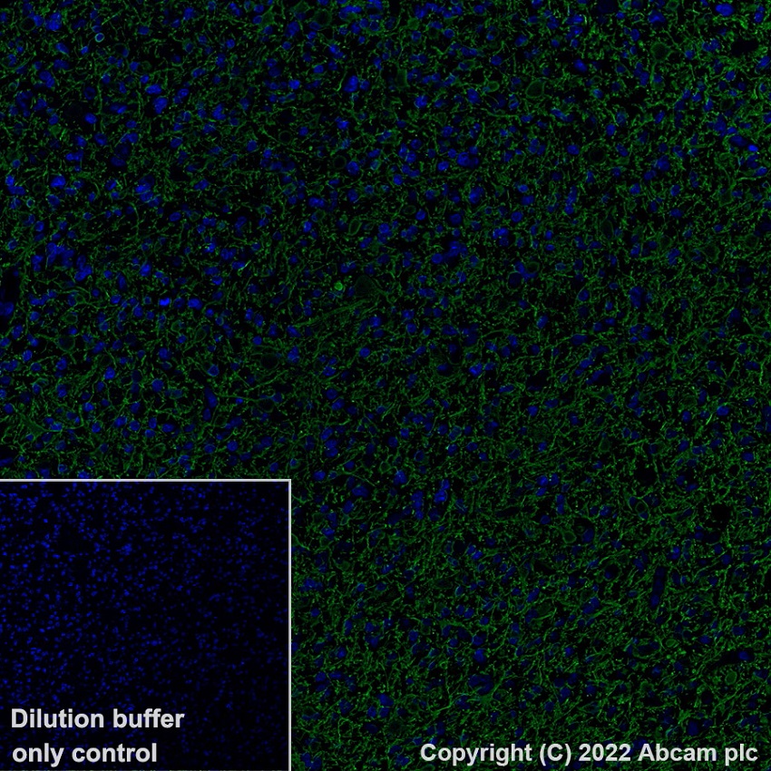 Alexa Fluor® 488 Anti-GFAP antibody [EP672Y] - Astrocyte marker