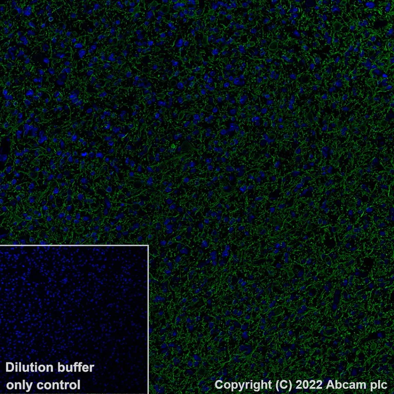 Immunohistochemistry (Formalin/PFA-fixed paraffin-embedded sections) - Alexa Fluor® 488 Anti-GFAP antibody [EP672Y] - Astrocyte marker (AB302977)