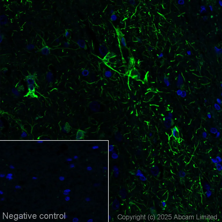 Immunohistochemistry (Formalin/PFA-fixed paraffin-embedded sections) - Alexa Fluor® 488 Anti-GFAP antibody [EP672Y] - Astrocyte marker (AB302977)