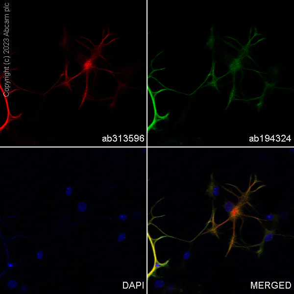 Immunocytochemistry/ Immunofluorescence - Alexa Fluor® 488 Anti-GFAP antibody [EPR1034Y] - Astrocyte Marker (AB194324)