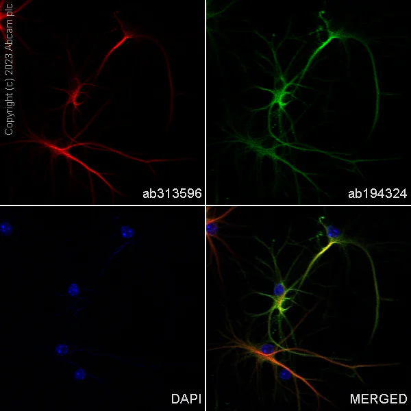 Immunocytochemistry/ Immunofluorescence - Alexa Fluor® 488 Anti-GFAP antibody [EPR1034Y] - Astrocyte Marker (AB194324)