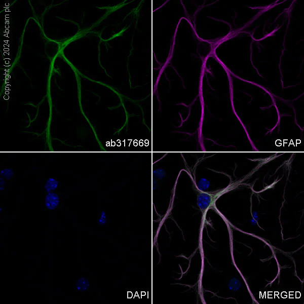 Immunocytochemistry/ Immunofluorescence - Alexa Fluor® 488 Anti-GFAP antibody [EPR1034Y] - Mouse IgG1 (Chimeric) (AB317669)