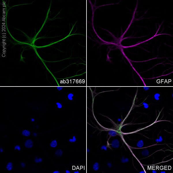 Immunocytochemistry/ Immunofluorescence - Alexa Fluor® 488 Anti-GFAP antibody [EPR1034Y] - Mouse IgG1 (Chimeric) (AB317669), expandable thumbnail