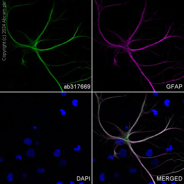Immunocytochemistry/ Immunofluorescence - Alexa Fluor® 488 Anti-GFAP antibody [EPR1034Y] - Mouse IgG1 (Chimeric) (AB317669)