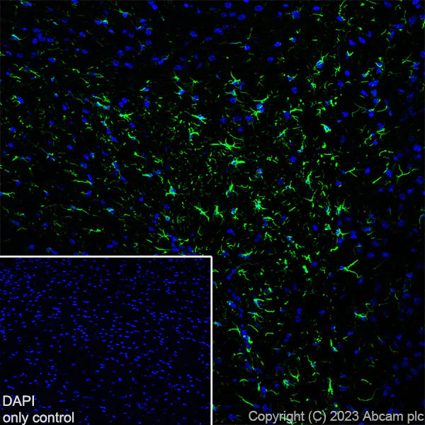 Immunohistochemistry (Frozen sections) - Alexa Fluor® 488 Anti-GFAP antibody [EPR1034Y] - Mouse IgG1 (Chimeric) (AB317669)