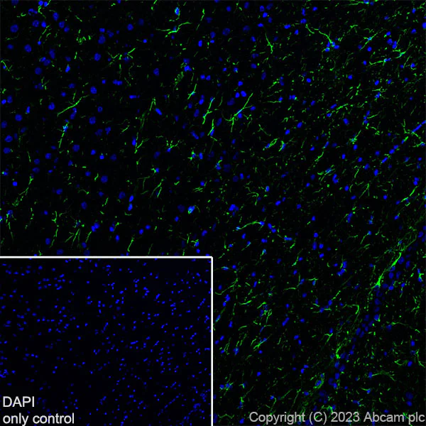 Immunohistochemistry (Frozen sections) - Alexa Fluor® 488 Anti-GFAP antibody [EPR1034Y] - Mouse IgG1 (Chimeric) (AB317669)