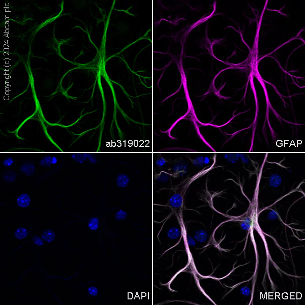 Immunocytochemistry/ Immunofluorescence - Alexa Fluor® 488 Anti-GFAP antibody [EPR1034Y] - Mouse IgG2a (Chimeric) (AB319022)