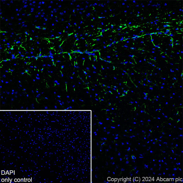 Immunohistochemistry (Frozen sections) - Alexa Fluor® 488 Anti-GFAP antibody [EPR1034Y] - Mouse IgG2a (Chimeric) (AB319022)