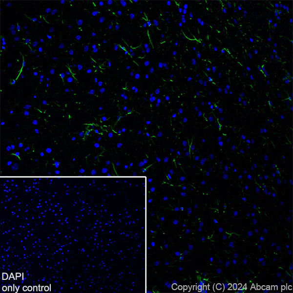 Immunohistochemistry (Frozen sections) - Alexa Fluor® 488 Anti-GFAP antibody [EPR1034Y] - Mouse IgG2a (Chimeric) (AB319022)