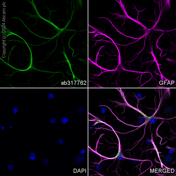 Immunocytochemistry/ Immunofluorescence - Alexa Fluor® 488 Anti-GFAP antibody [EPR1034Y] - Rat IgG2a (Chimeric) (AB317762), expandable thumbnail