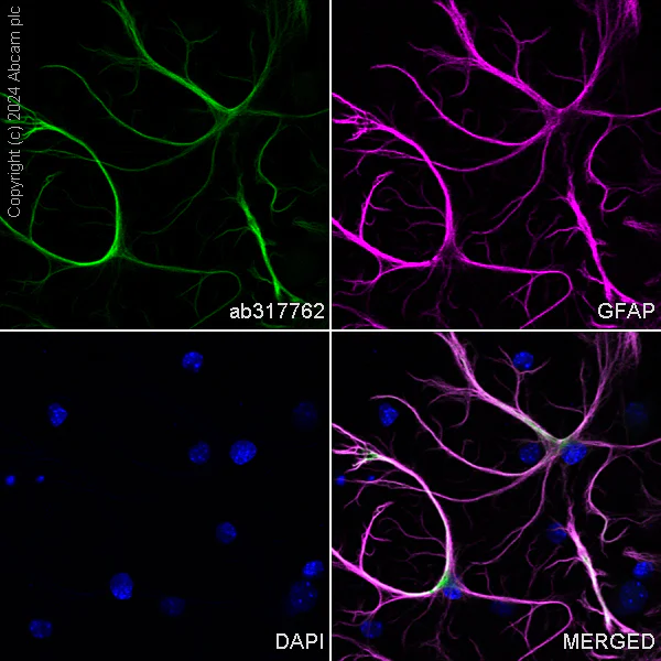 Immunocytochemistry/ Immunofluorescence - Alexa Fluor® 488 Anti-GFAP antibody [EPR1034Y] - Rat IgG2a (Chimeric) (AB317762)