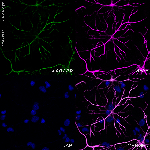 Immunocytochemistry/ Immunofluorescence - Alexa Fluor® 488 Anti-GFAP antibody [EPR1034Y] - Rat IgG2a (Chimeric) (AB317762), expandable thumbnail