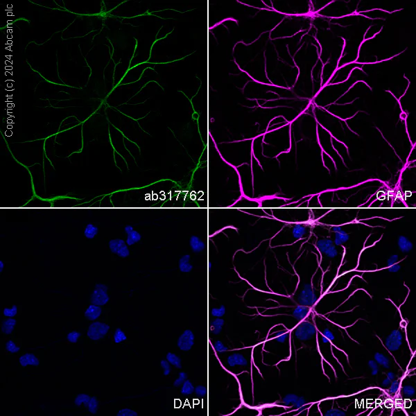 Immunocytochemistry/ Immunofluorescence - Alexa Fluor® 488 Anti-GFAP antibody [EPR1034Y] - Rat IgG2a (Chimeric) (AB317762)