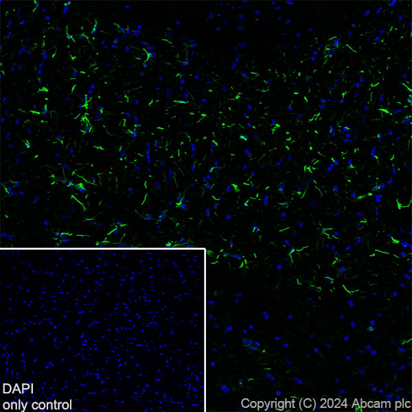 Immunohistochemistry (Frozen sections) - Alexa Fluor® 488 Anti-GFAP antibody [EPR1034Y] - Rat IgG2a (Chimeric) (ab317762), expandable thumbnail