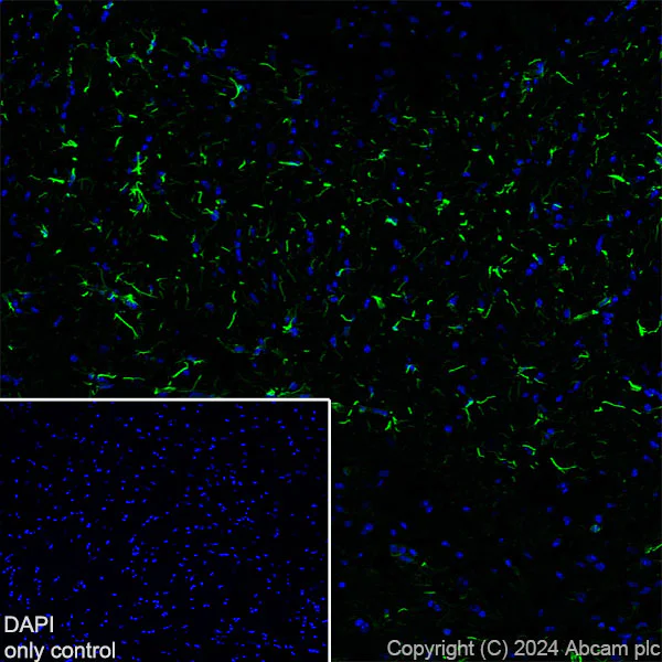 Immunohistochemistry (Frozen sections) - Alexa Fluor® 488 Anti-GFAP antibody [EPR1034Y] - Rat IgG2a (Chimeric) (AB317762)