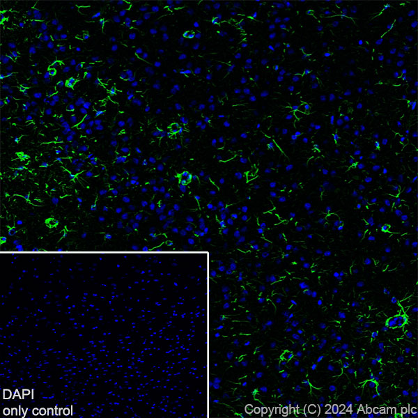 Immunohistochemistry (Frozen sections) - Alexa Fluor® 488 Anti-GFAP antibody [EPR1034Y] - Rat IgG2a (Chimeric) (AB317762), expandable thumbnail