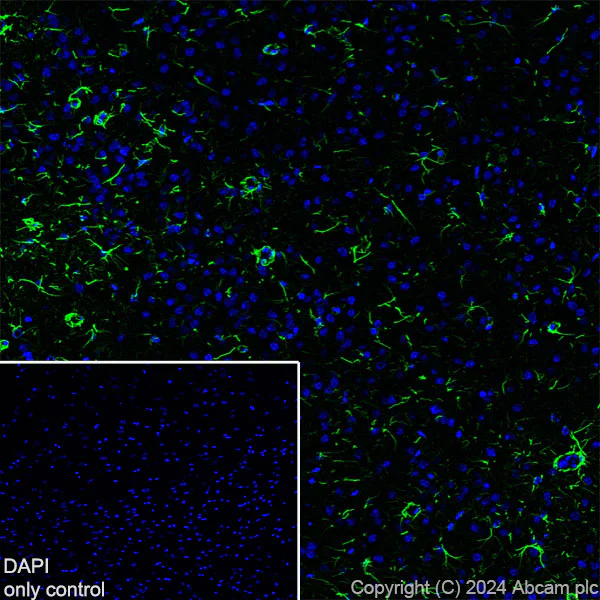 Immunohistochemistry (Frozen sections) - Alexa Fluor® 488 Anti-GFAP antibody [EPR1034Y] - Rat IgG2a (Chimeric) (AB317762)