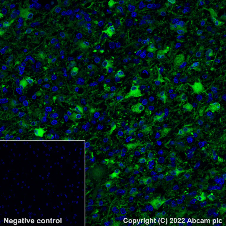 Immunohistochemistry - Alexa Fluor® 488 Anti-Glutamine Synthetase antibody [EPR13022(B)] (AB302584)