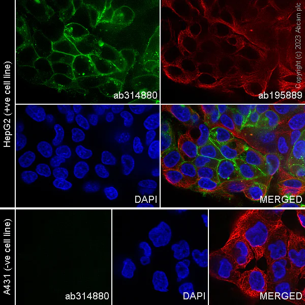 Immunocytochemistry/ Immunofluorescence - Alexa Fluor® 488 Anti-Glypican 3 antibody [SP86] (AB314880)