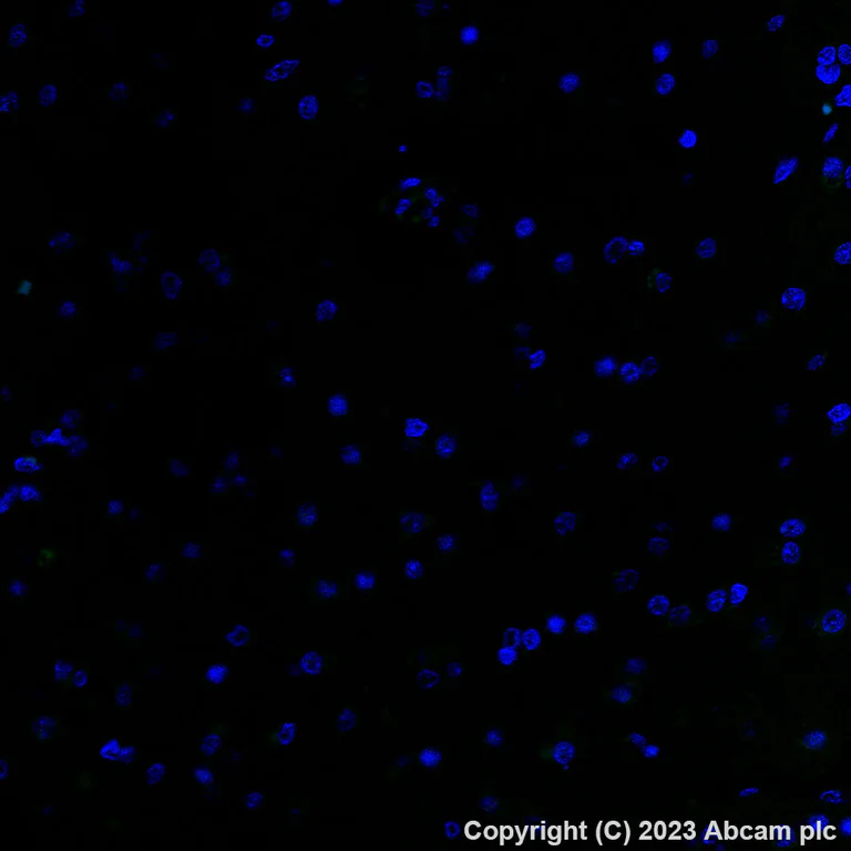 Immunohistochemistry (Formalin/PFA-fixed paraffin-embedded sections) - Alexa Fluor® 488 Anti-Glypican 3 antibody [SP86] (AB314880)