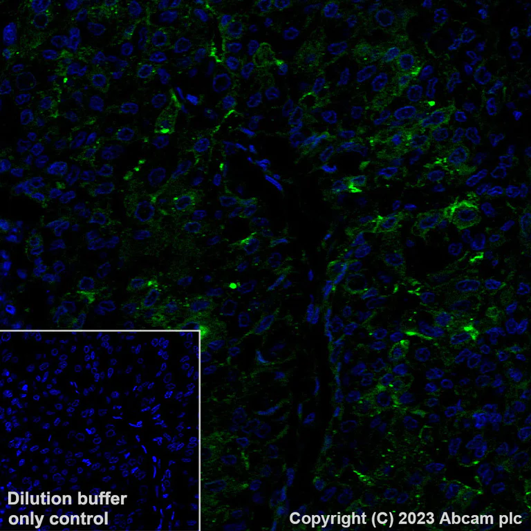 Immunohistochemistry (Formalin/PFA-fixed paraffin-embedded sections) - Alexa Fluor® 488 Anti-Glypican 3 antibody [SP86] (AB314880)
